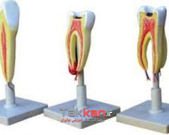مولاژ مدل دندان-1402/4978
